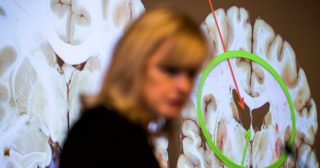 A neuropathologist will study slices of Shane Tamura’s brain to determine if he had C.T.E. Above, Dr. Ann McKee of Boston University presenting her findings in 2017 from her examination of another former football player, Aaron Hernandez of the New England Patriots.